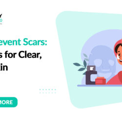 How-to-Prevent-Scars